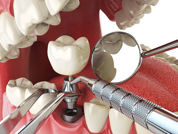 Best Emergency Cosmetic Dentistry (e.g., broken veneers) in Newington Forest, VA