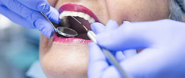 Best Emergency Dental Care for Sports Injuries in Newington Forest, VA