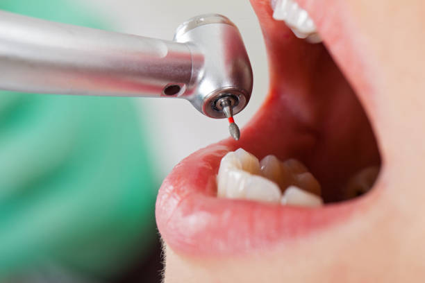 Best Emergency Root Canal Therapy in Newington Forest, VA